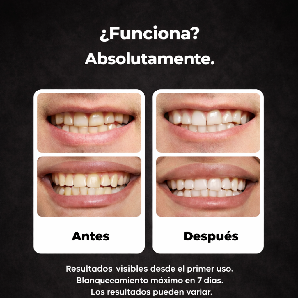 Tiras Blanqueadoras Dentales con Carbón Activado
